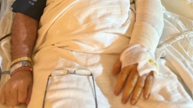 El caso de Mark Brooks alerta sobre el peligro de infecciones bacterianas que pueden comenzar con síntomas leves.
