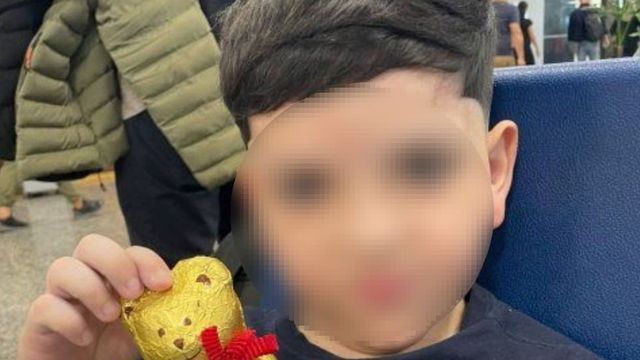 Cómo sigue Bastian, el niño que sufrió un terrible accidente en Pinamar.