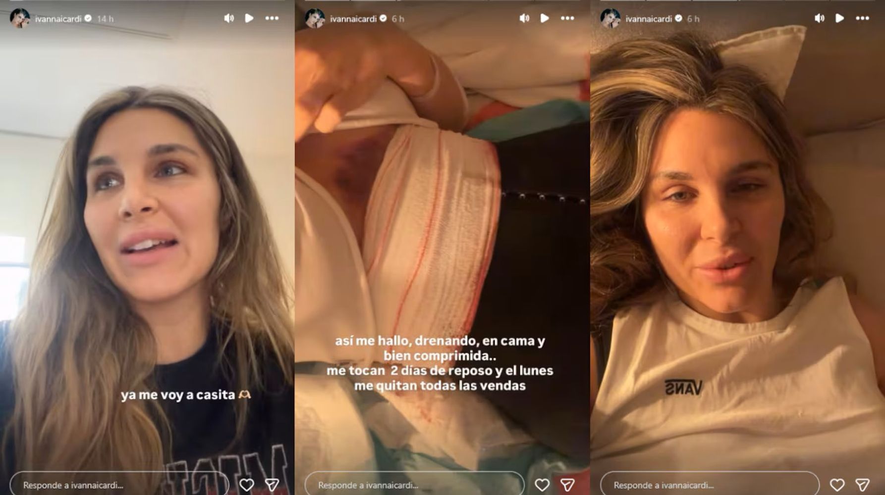 Ivana Icardi, recién operada