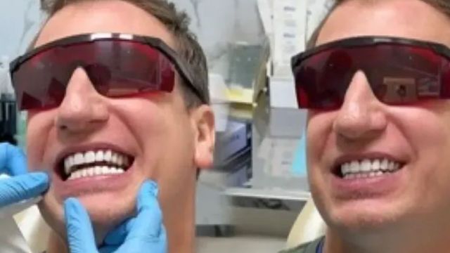Un odontólogo cordobés analizó la sonrisa de Maxi López. 