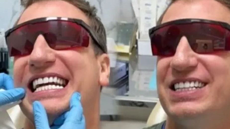 "Parecen teclas": un odontólogo de Córdoba fulminó a Maxi López por su sonrisa
