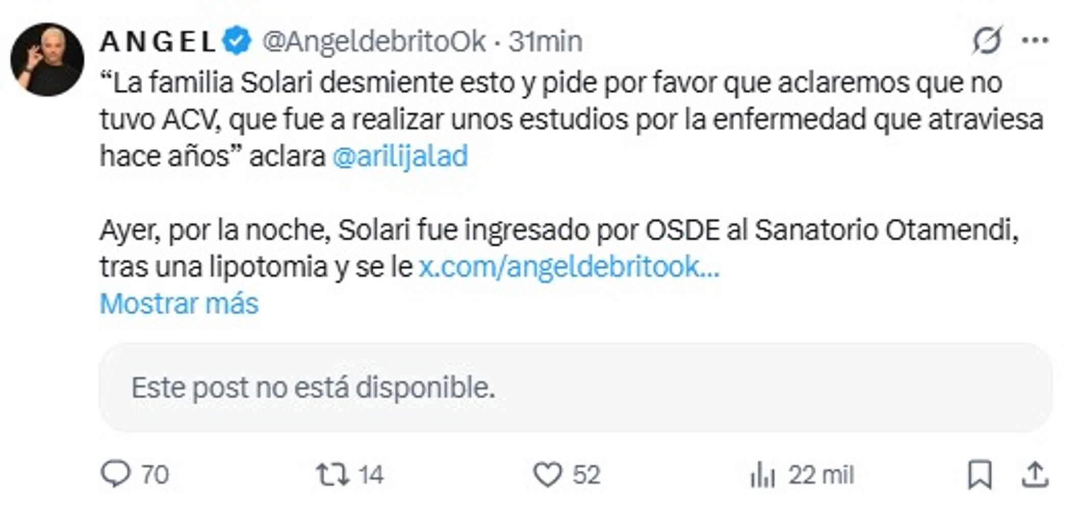 Preocupación por el Indio Solari: la familia desmiente un ACV y aclara su verdadero estado de salud