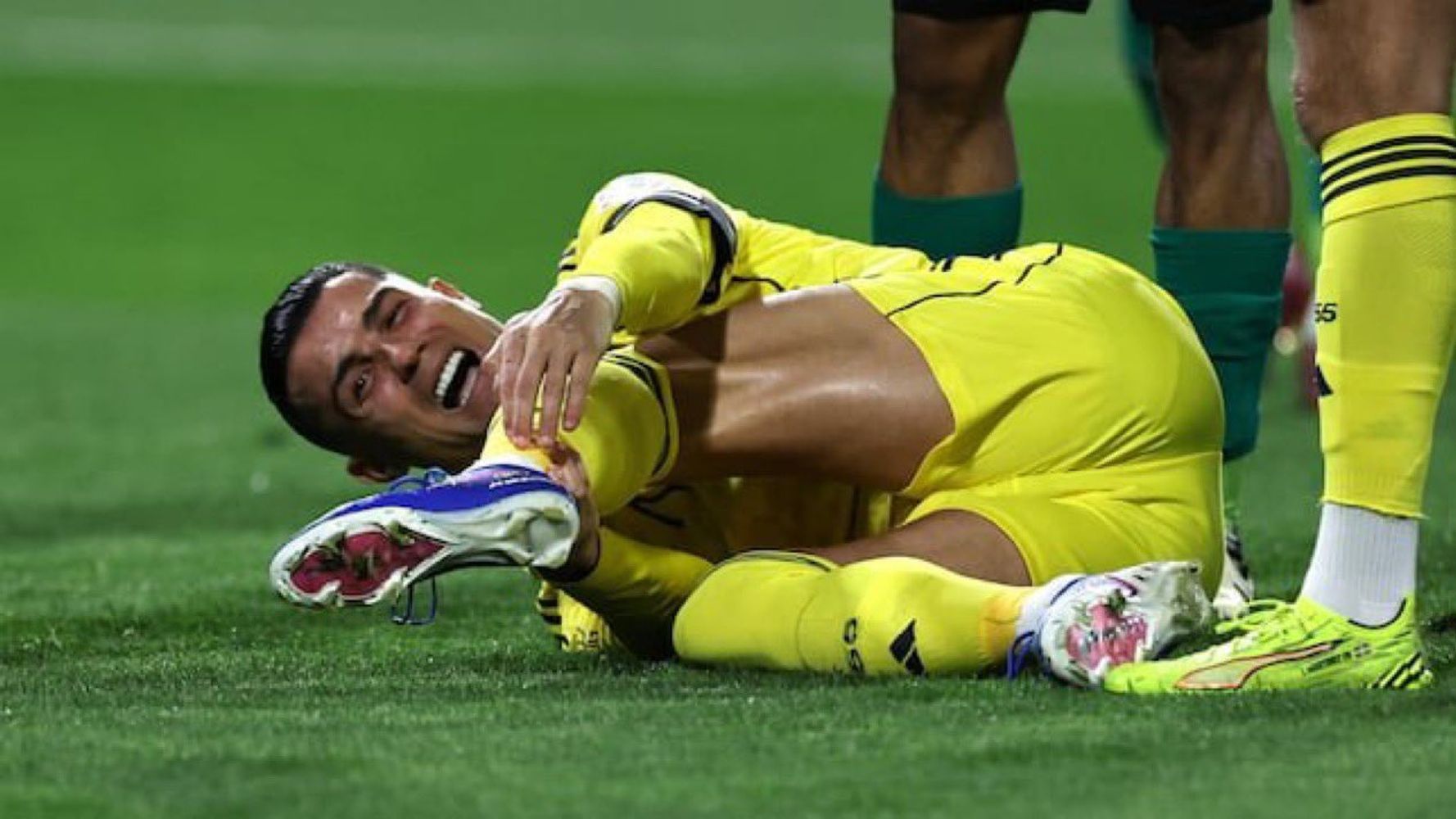Ronaldo y una lesión más grave de lo esperado