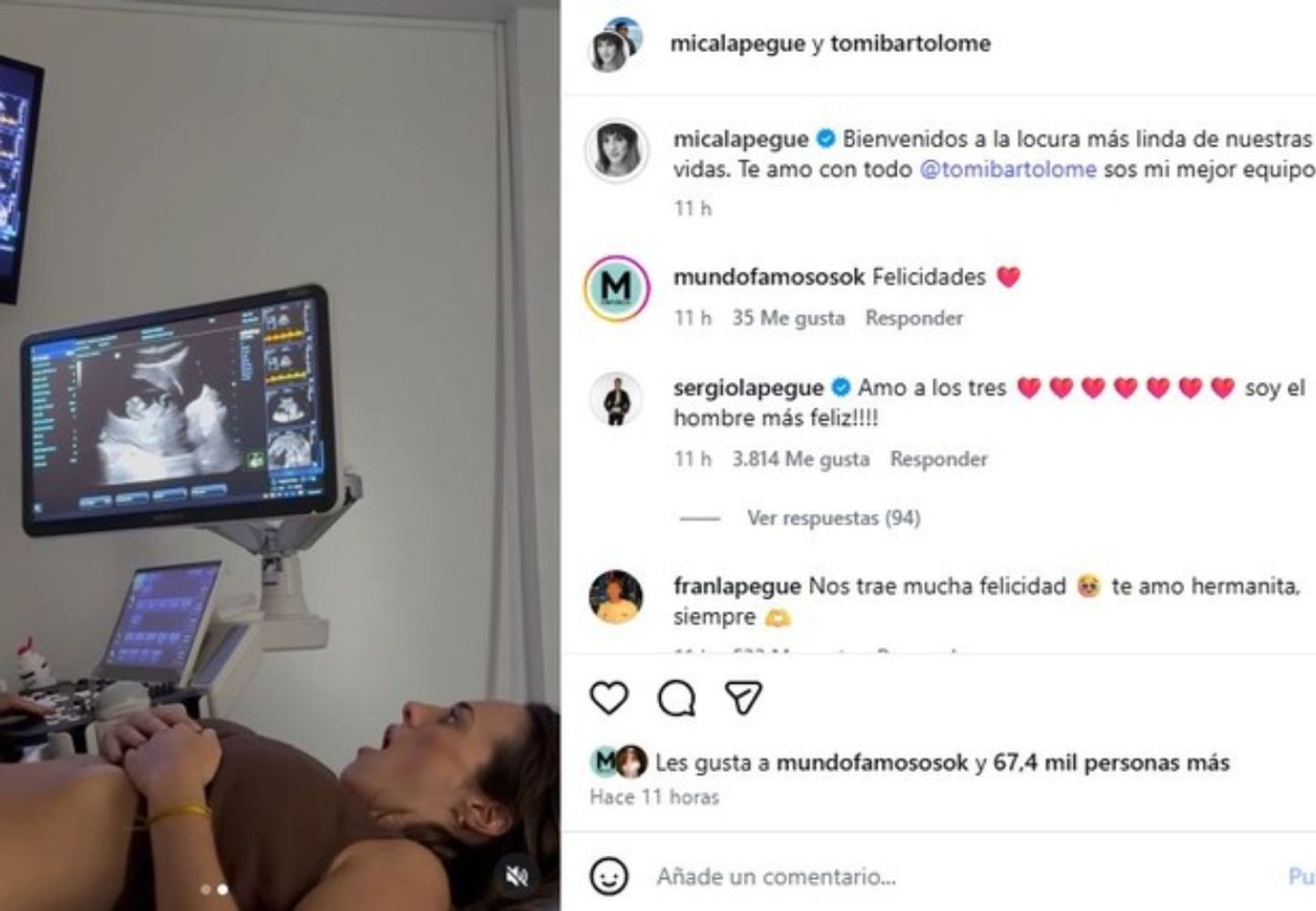 Micaela Lapegüe está embarazada.