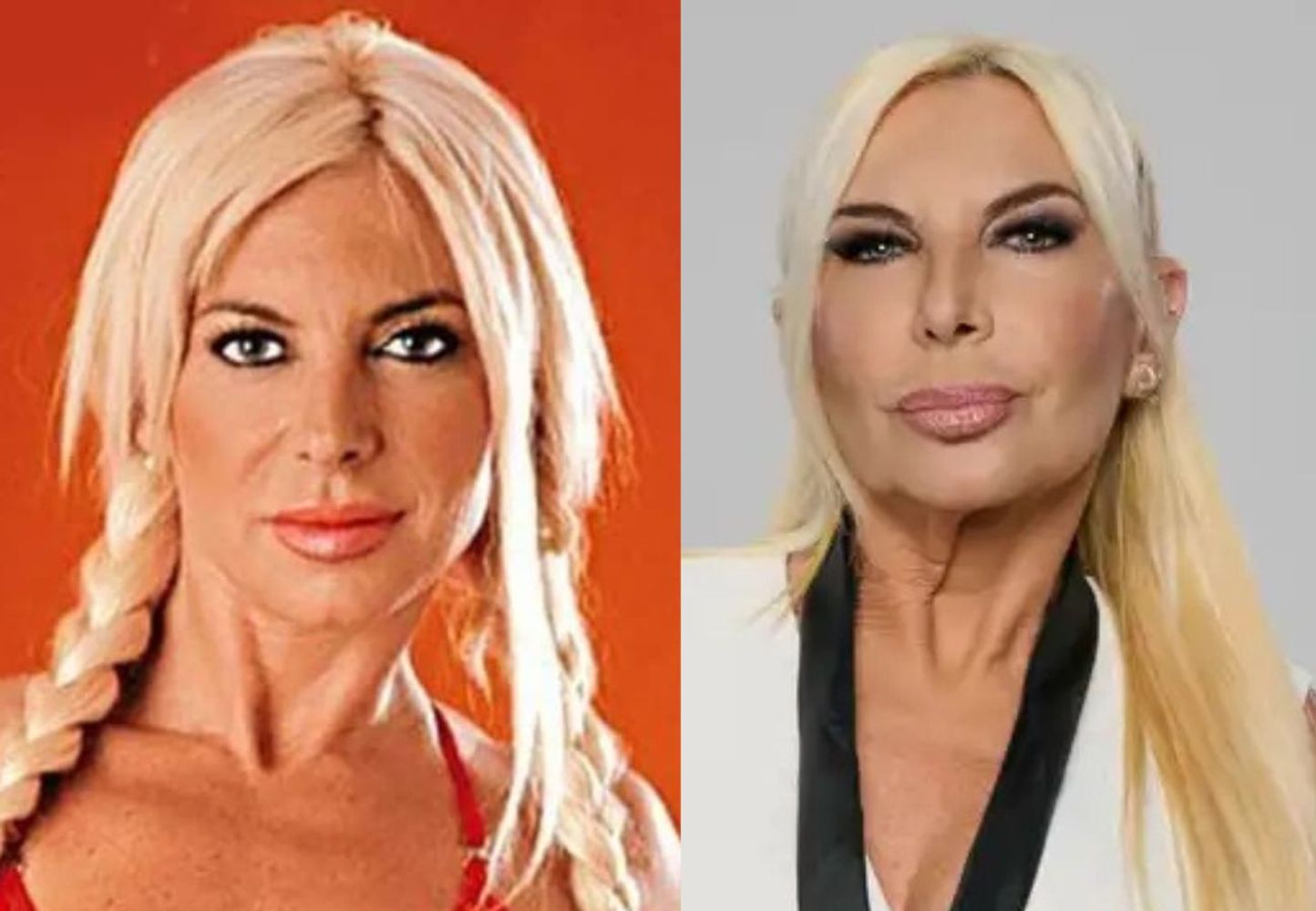 Yanina Zilli: antes y después.