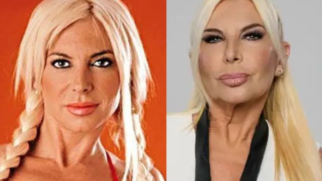 Yanina Zilli: antes y después.