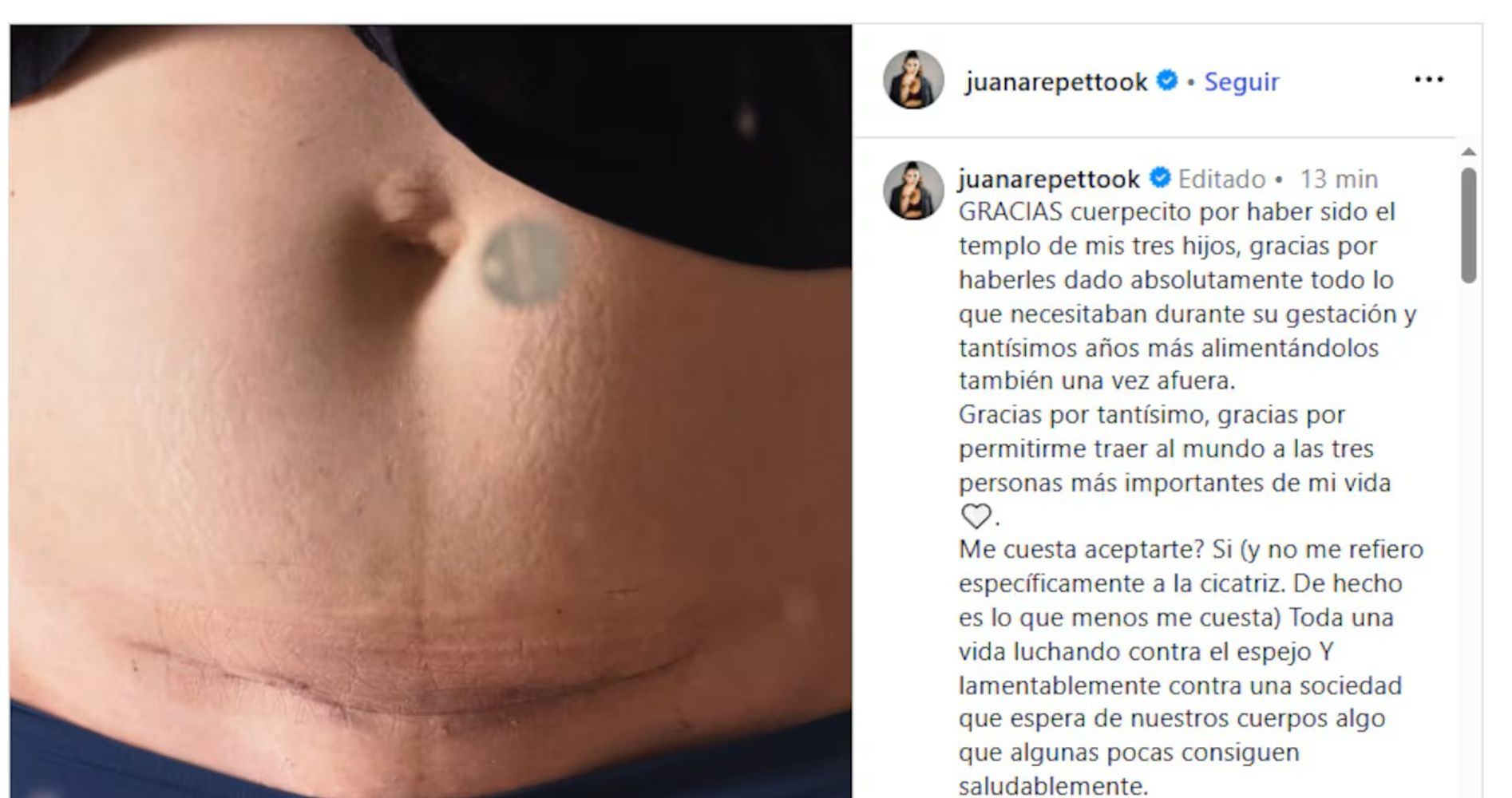 Juana Repetto