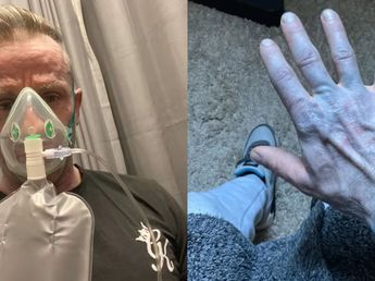 Se despertó con la piel azul, fue al hospital de urgencia y los médicos descubrieron una insólita explicación