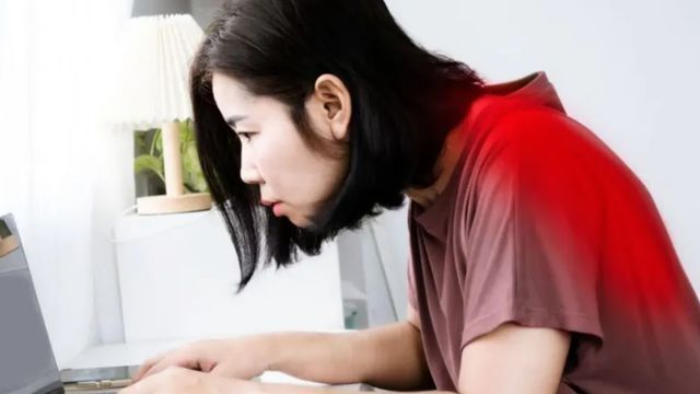 La joroba de oficina afecta a quienes pasan largas horas frente a la computadora con mala postura.