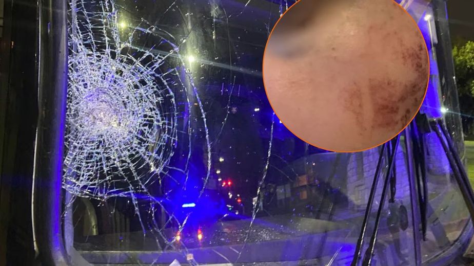 "Me desangraba": el calvario de una joven tras un ataque a piedrazos a un colectivo en Córdoba