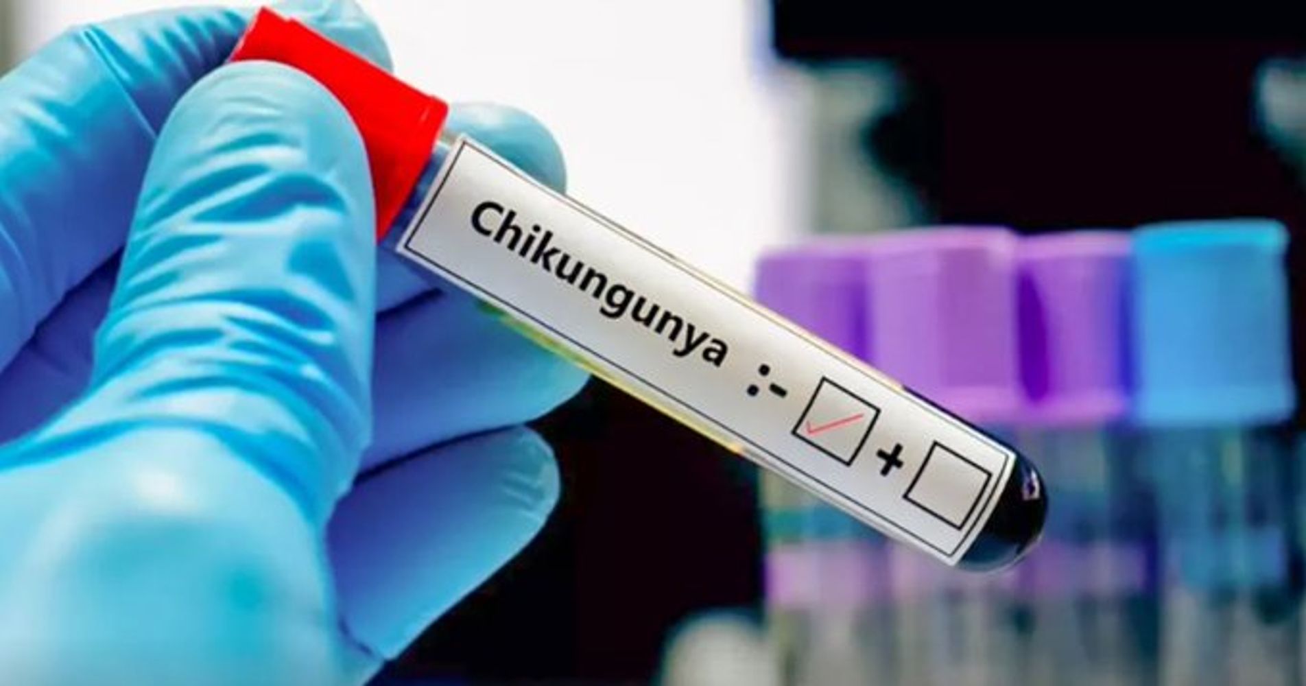 Tres nuevos casos de chikunguña en Córdoba.