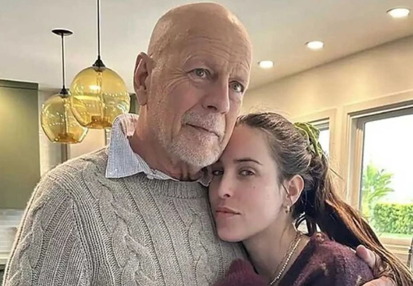 El síntoma de la enfermedad de Bruce Willis que su familia confundió y por qué no detectaron antes la demencia
