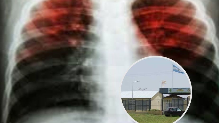 Alerta por tuberculosis en una cárcel de Entre Ríos: aíslan internos y refuerzan controles sanitarios