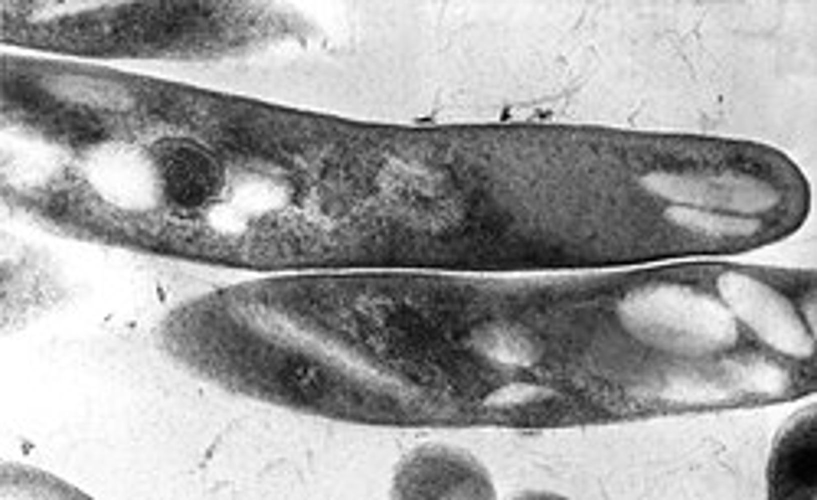 Turberculosis