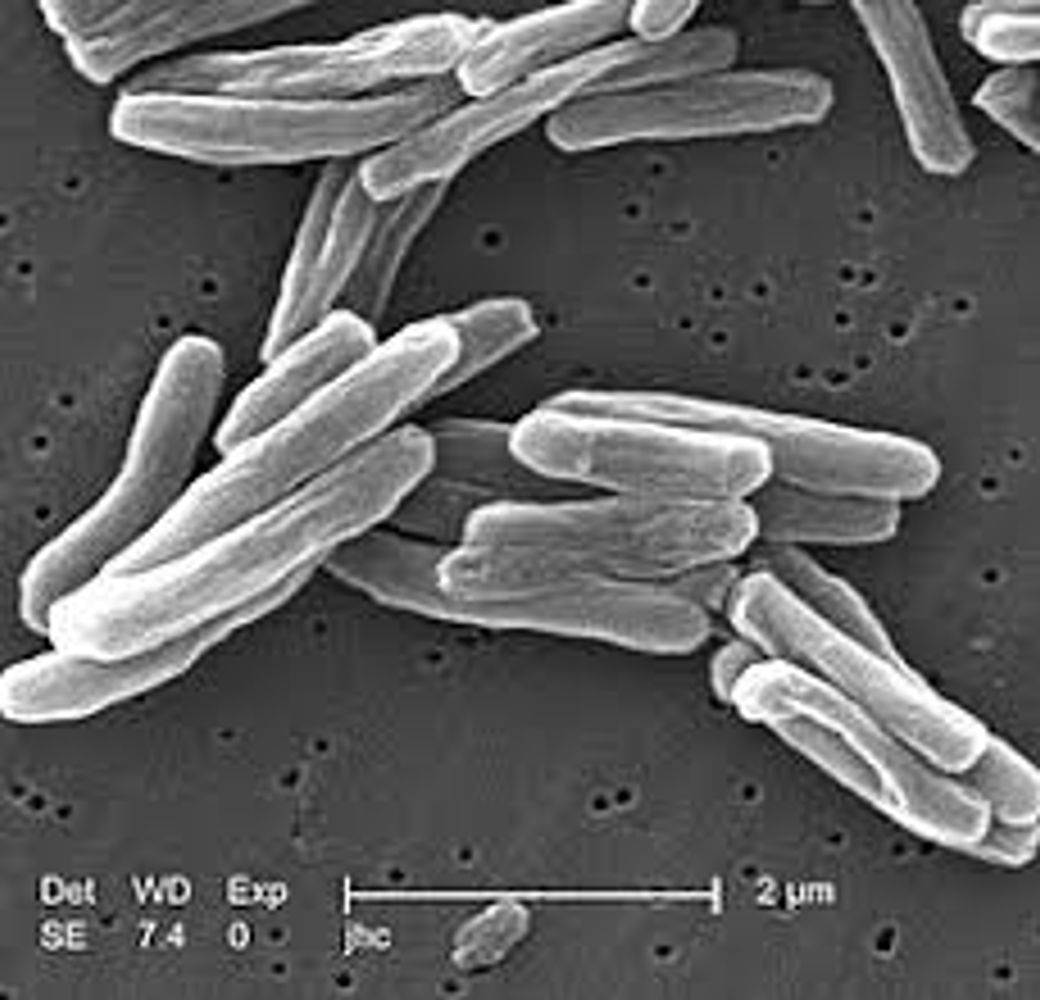 Turberculosis