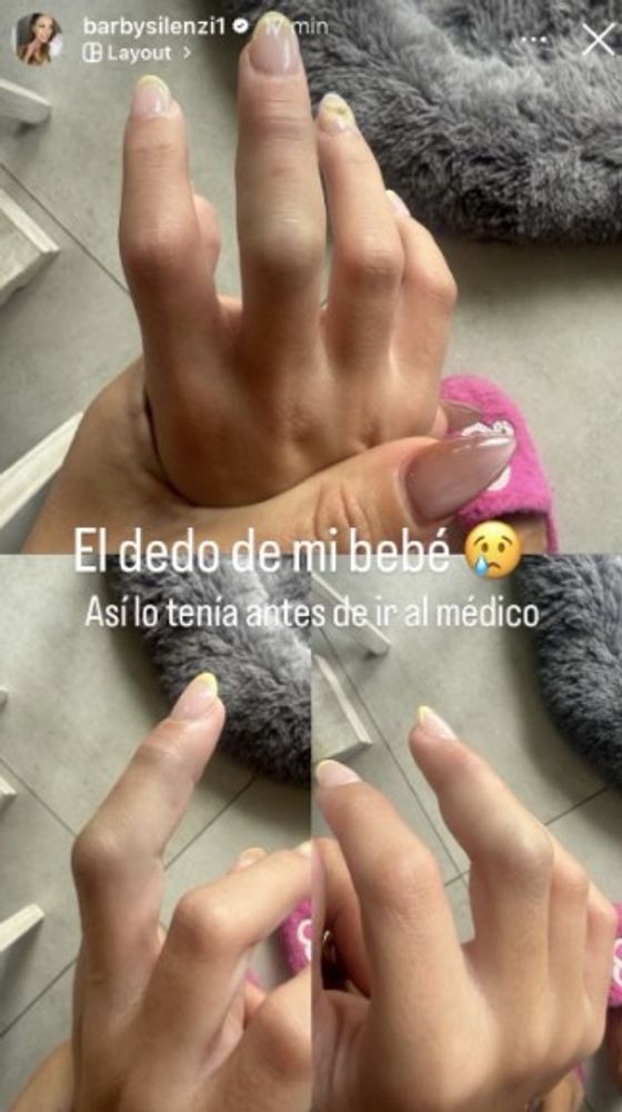 Accidente de la hija de Barby Silenzi
