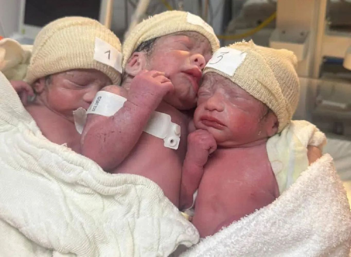 Emoción en Concordia: nacieron trillizos en el hospital Masvernat.