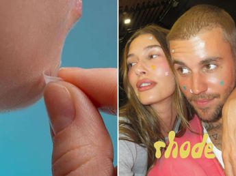 Ni crema ni maquillaje: el truco para eliminar granitos rápido sin lastimar la piel