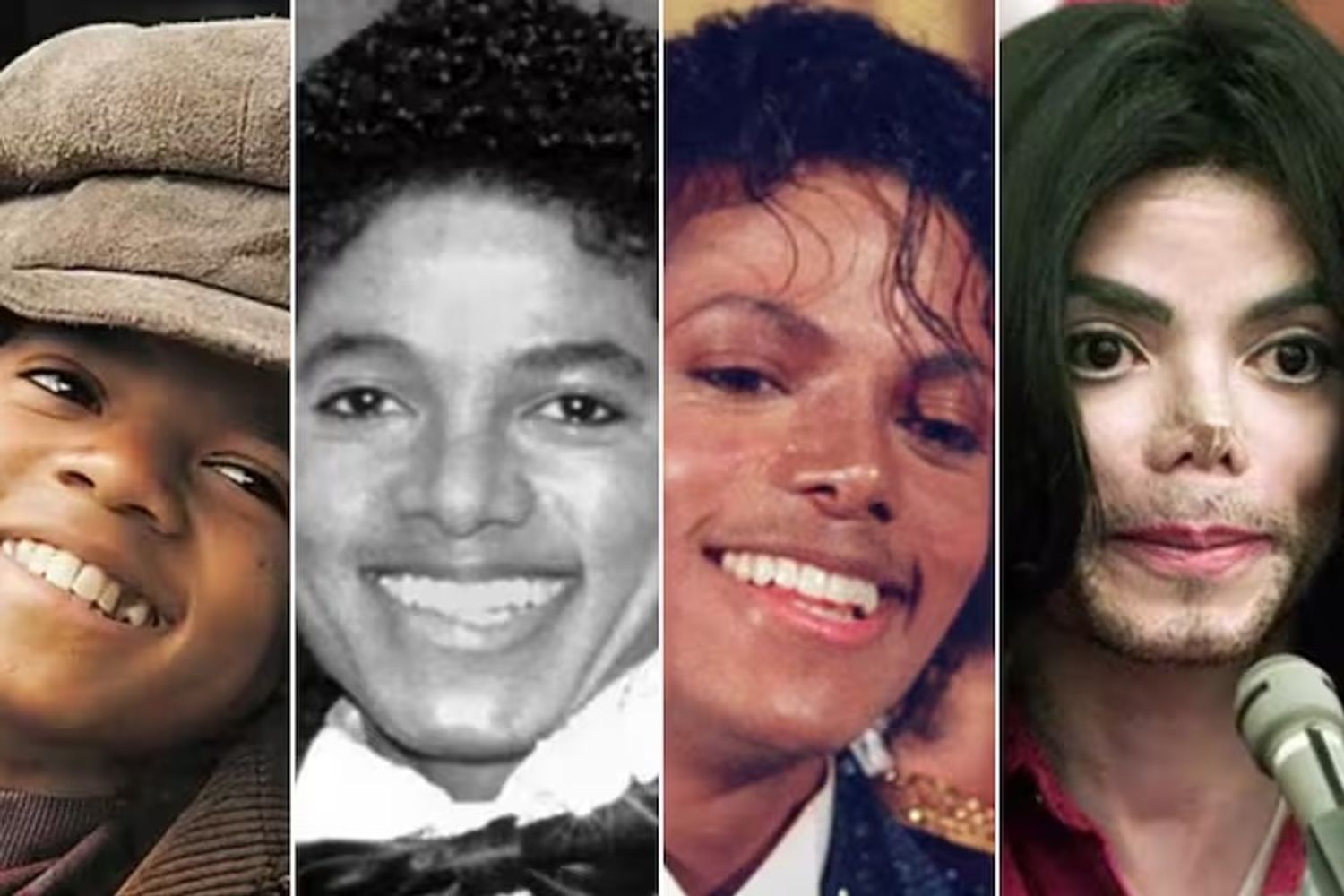 El vitíligo fue la enfermedad que Michael Jackson intentó ocultar durante gran parte de su carrera.