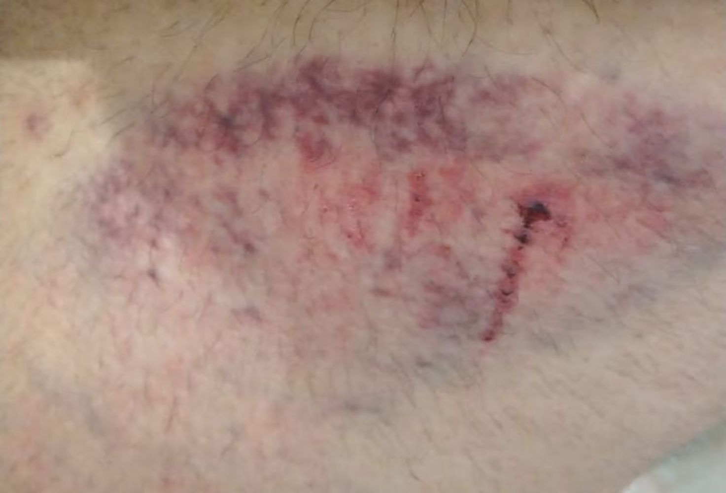 Algunas de las heridas de la trabajadora.