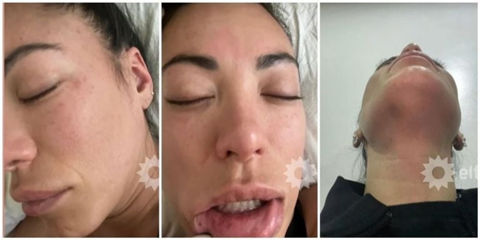 Las imágenes que muestran las lesiones de Pamela Pombo tras la presunta agresión de su ex marido.