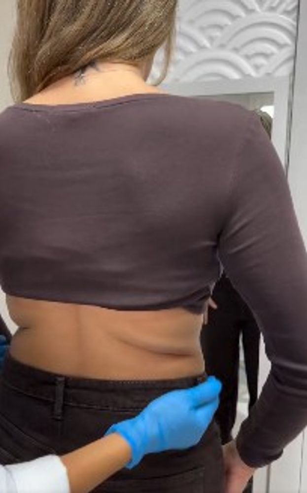 El cambio físico de Ivana Cardi tras su cirugía estética.