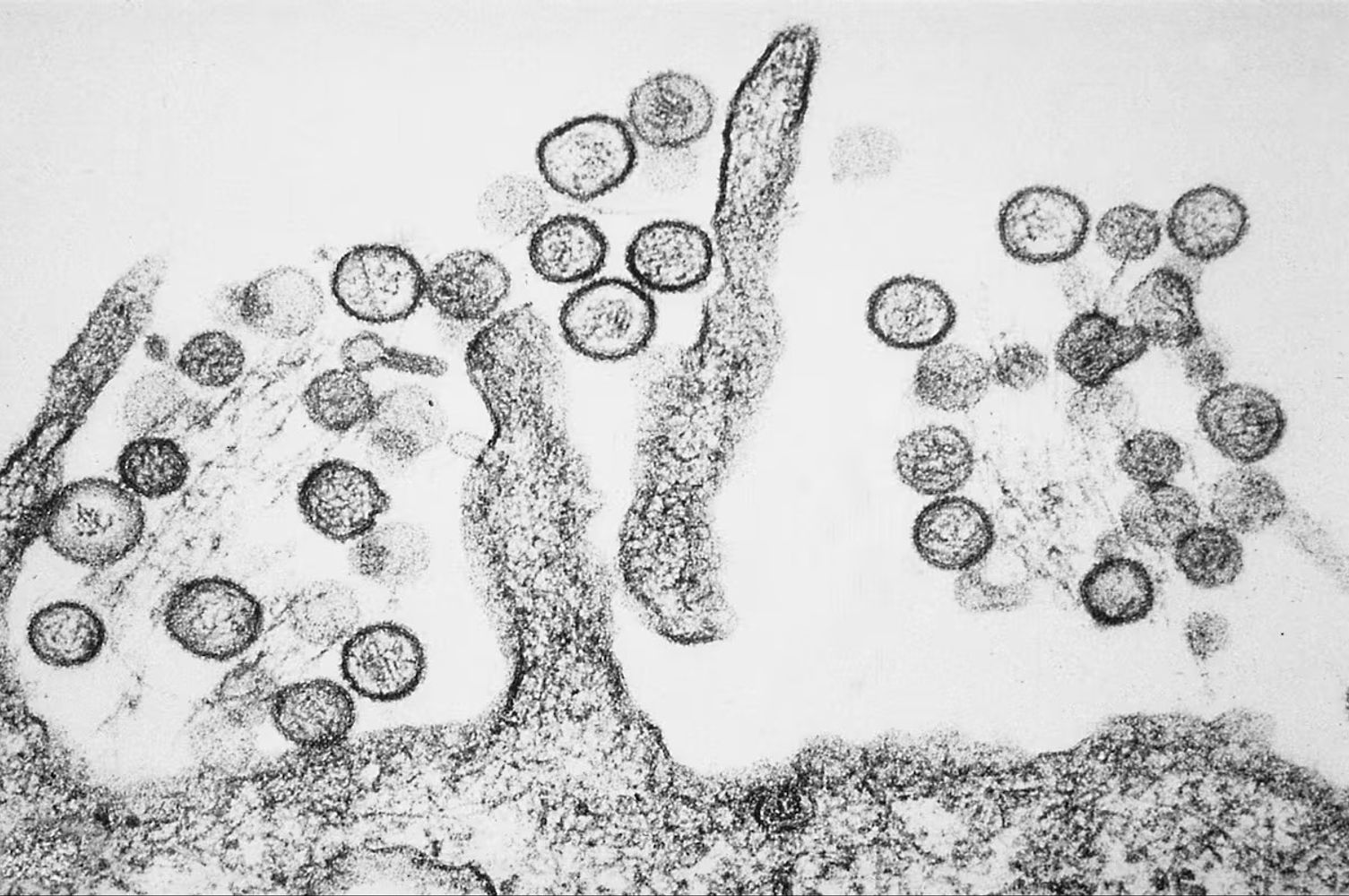 La Universidad Nacional de Córdoba tuvo un rol clave en la investigación por el Hantavirus.