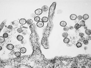 Qué es el Hantavirus, cómo se contagia y cuáles son sus síntomas