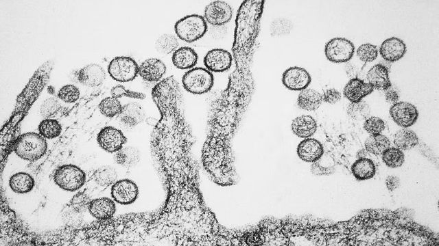 Hantavirus.