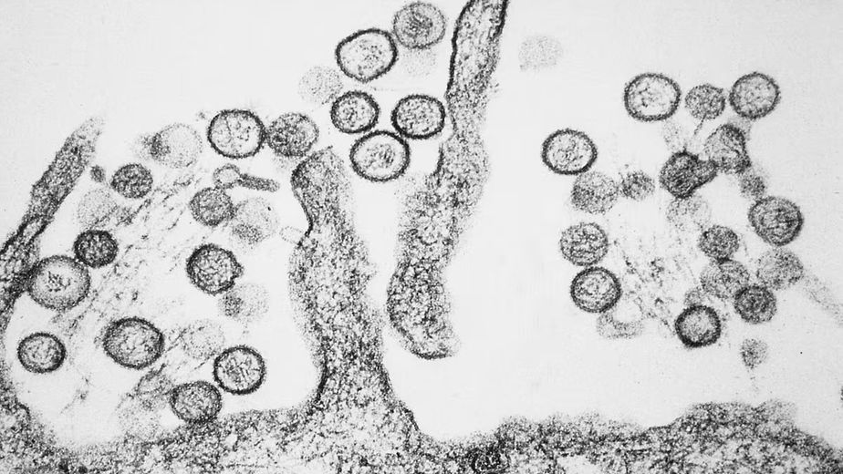 Qué es el Hantavirus, cómo se contagia y cuáles son sus síntomas