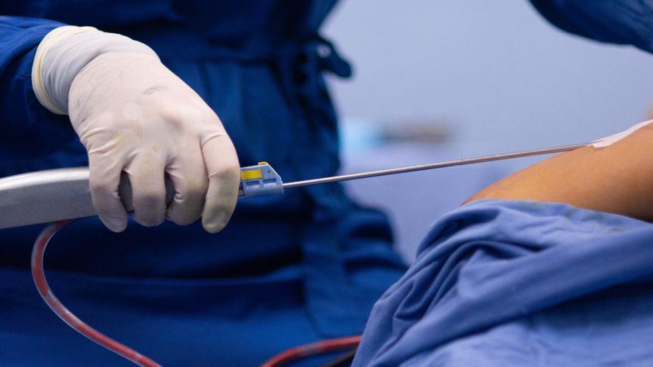 Fue a hacerse una liposucción en Rosario, murió dos semanas después y ahora juzgan al cirujano por mala praxis