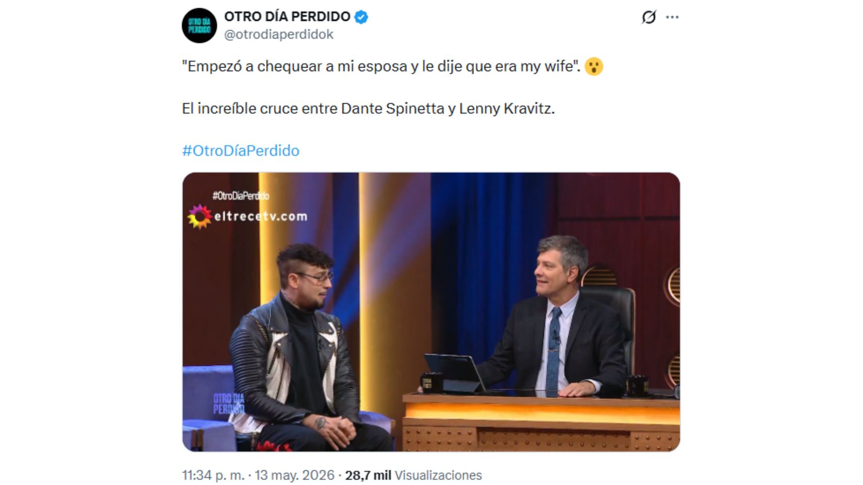El músico estuvo en el programa de Mario Pergolini.
