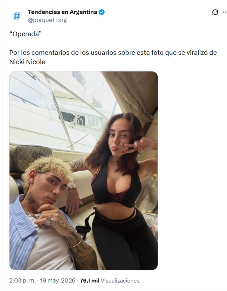 Nicki Nicole fue tendencia por una supuesta cirugía