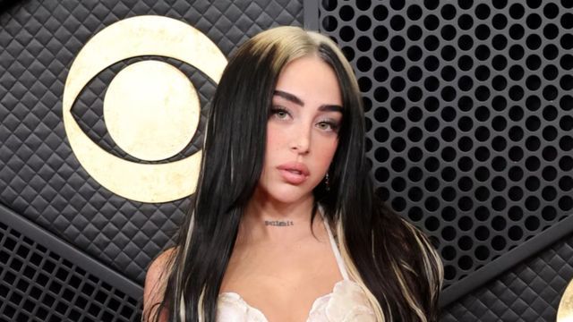 Nicki Nicole fue tendencia por una supuesta cirugía