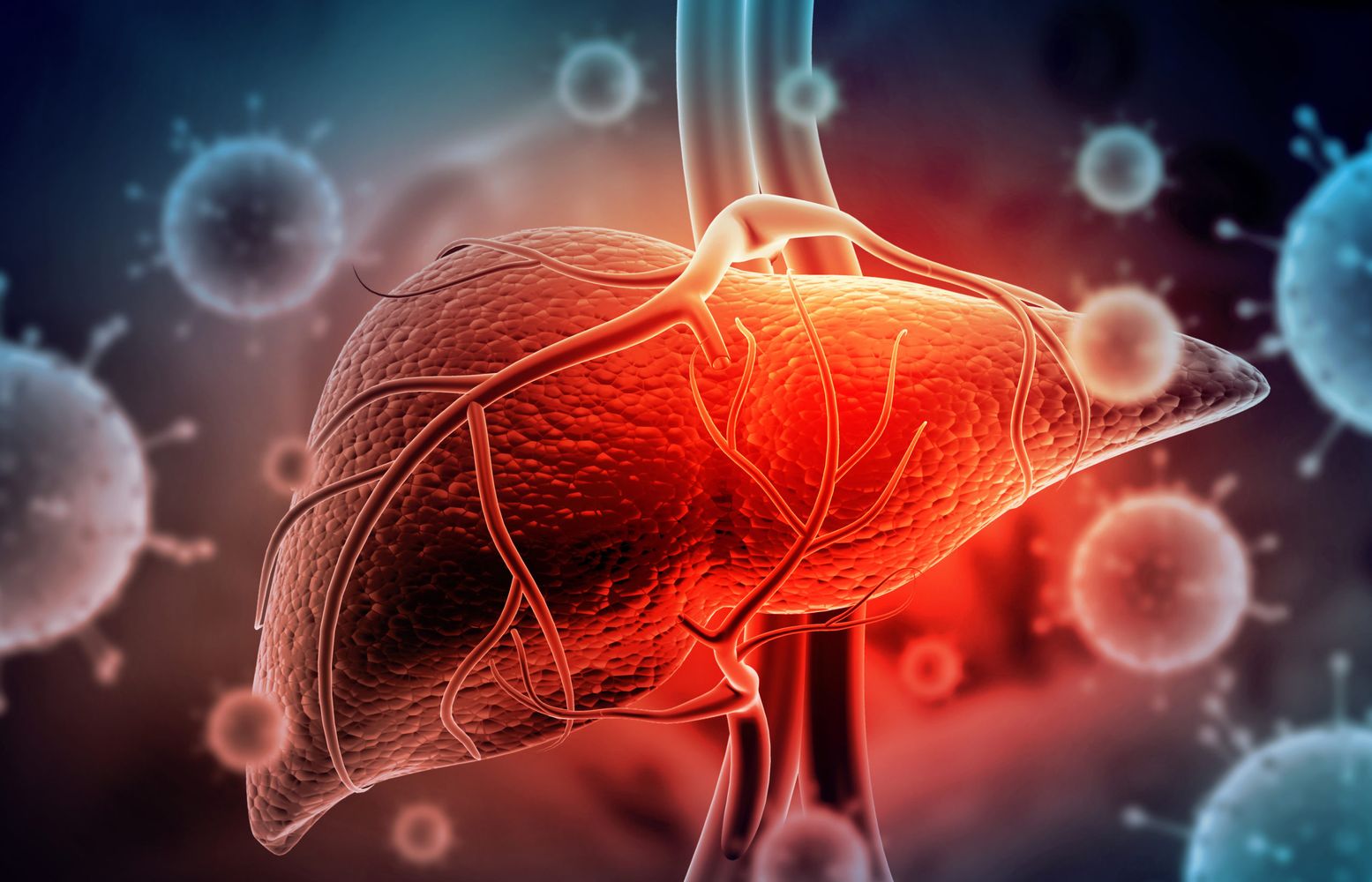 Hepatitis A.