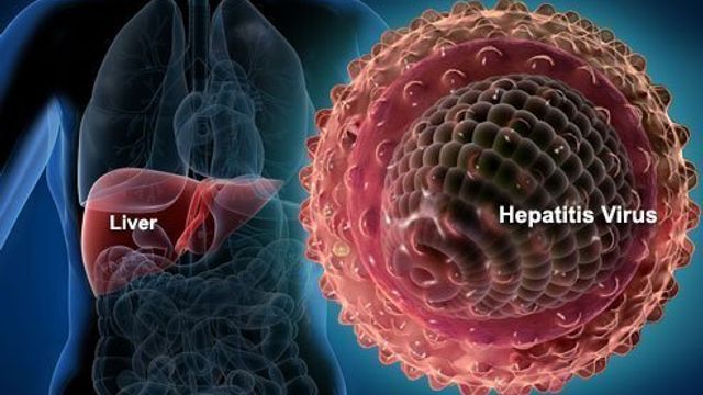 Hepatitis A.