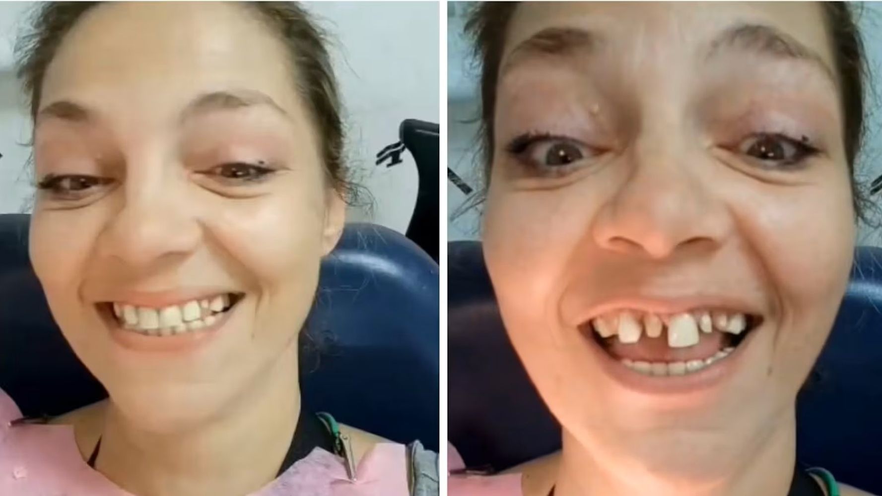Tamara Paganini cuando se hizo un tratamiento para los dientes en 2022
