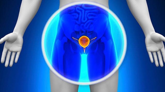 Cáncer de próstata