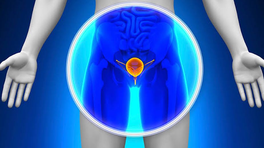 Punta Alta: campaña de detección del cáncer de próstata