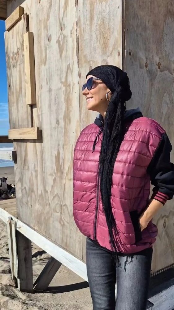Silvina Sccheffler contó cómo perdió el cabello por su enfermedad