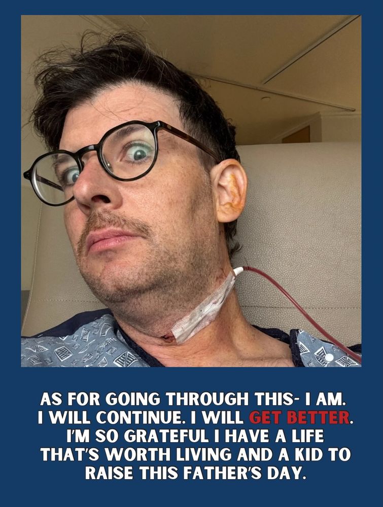 Moshe Kasher mostró la cicatriz que le dejó la operación.