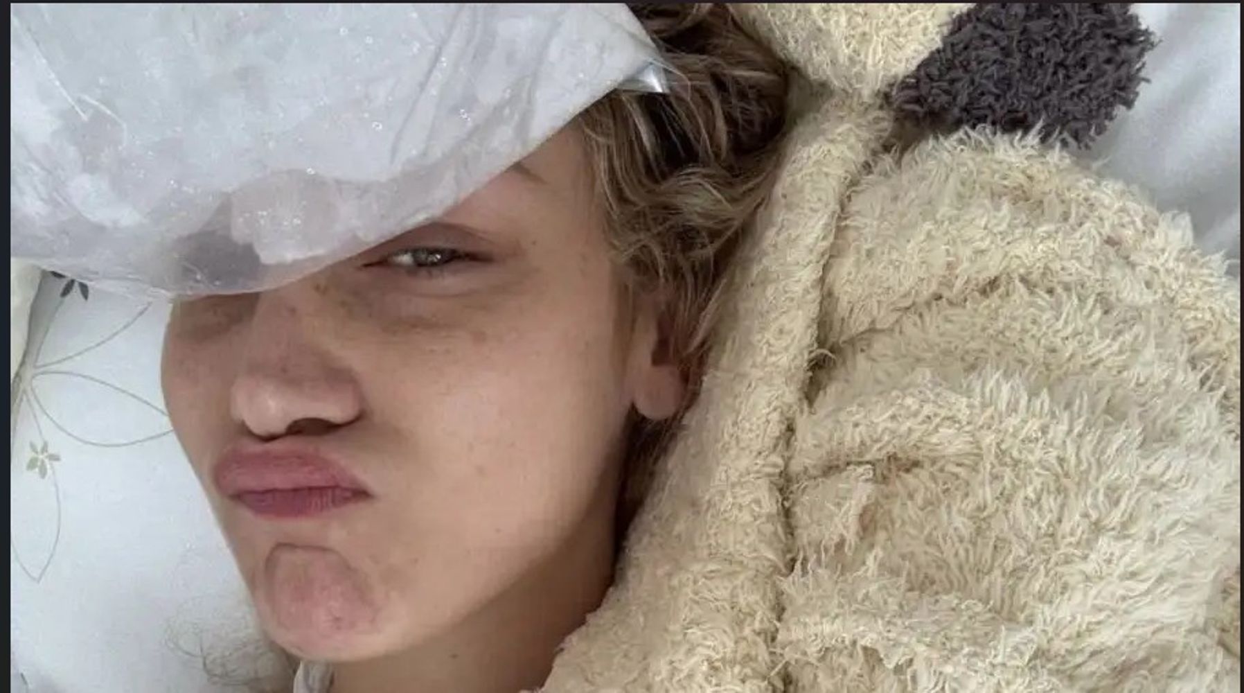 La enfermedad de Bella Hadid