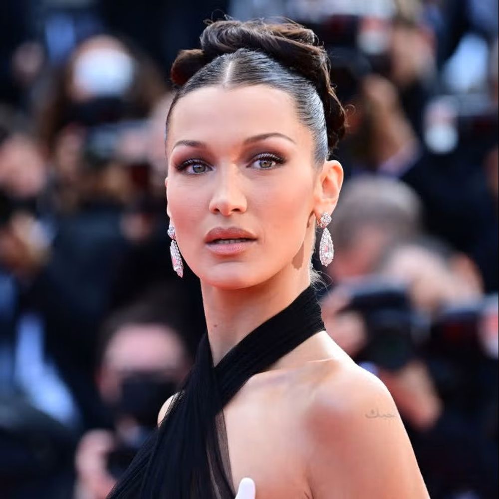 La enfermedad de Bella Hadid