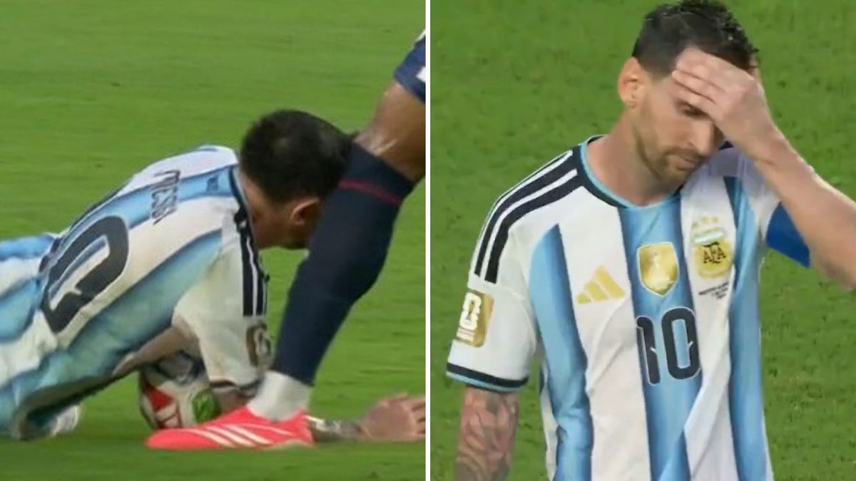 Así le quedó la cabeza a Lionel Messi tras el tremendo rodillazo de un rival