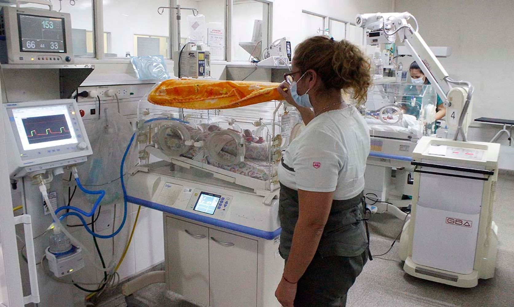 La intervención se realizó directamente en la servocuna del recién nacido, dentro de terapia intensiva.