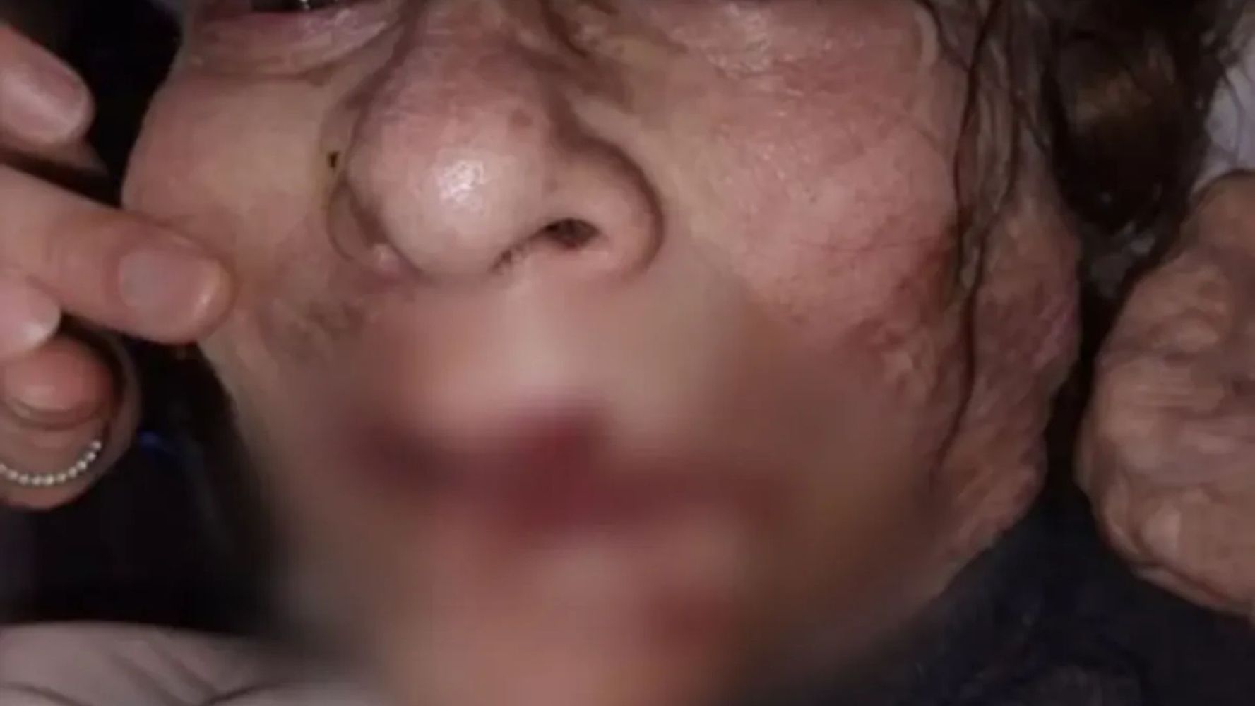 Un enfermero fue grabado golpeando ancianas en un geriátrico de Mar del Plata.
