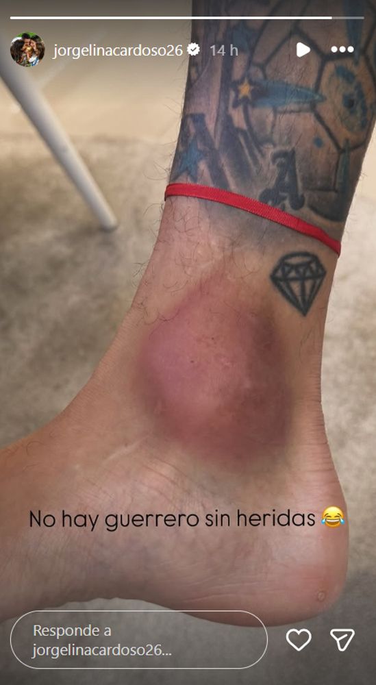 Así quedó el tobillo de Di María tras el partido con River