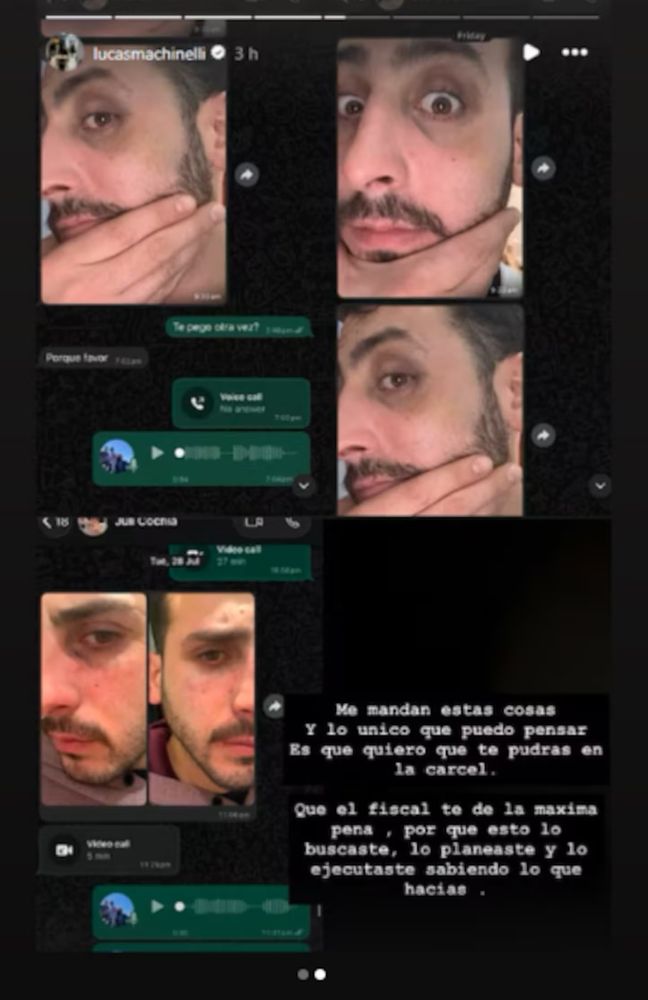 La foto que muestra las agresiones de Victoria a su novio en el caso de Chaco