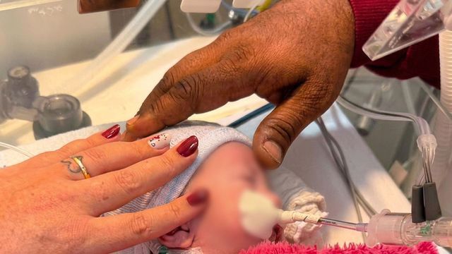 Un bebé fue declarado muerto y lo llevaron a la morgue: dos horas después descubrieron que estaba vivo.