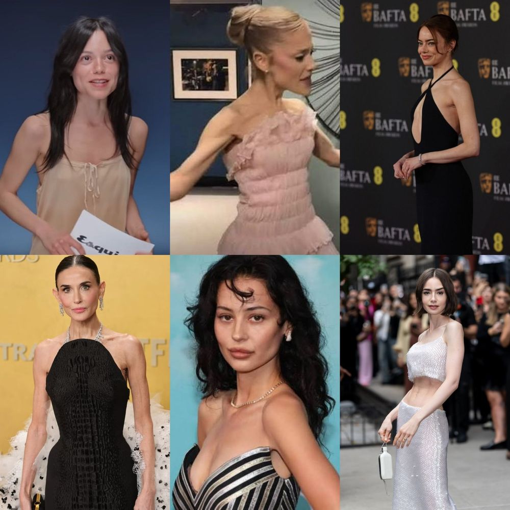 Actrices que han generado preocupación por su aspecto físico.
